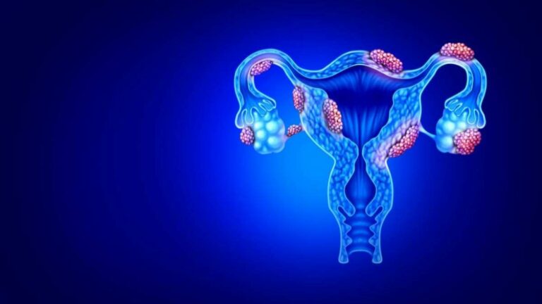 Unraveling the Enigma of Endometriosis: A Groundbreaking Discovery